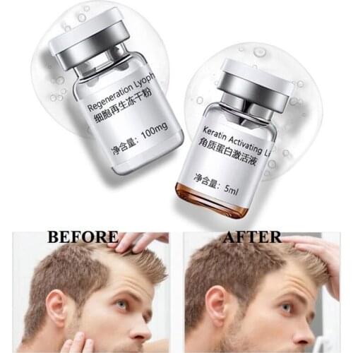 Stem Cell Hair Growth Serum Anti Hair Loss Repair Follicles Stimulation Hairline Fast Growth 2pcs/Set Hair Care Essence