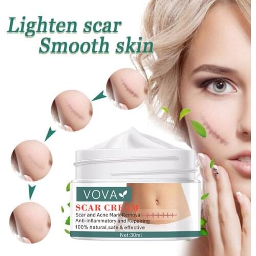 30ML Acne Scar Removal Cream Pimples Stretch Marks Face Gel Remove Acne Smoothing Whitening Moisturizing Body Skin Care