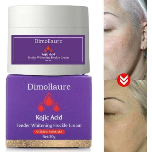 Dimollaure Kojic Acid whitening cream 30g Retinol Wrinkle removal Freckle melasma Acne scar pigment age spot melanin dark spot