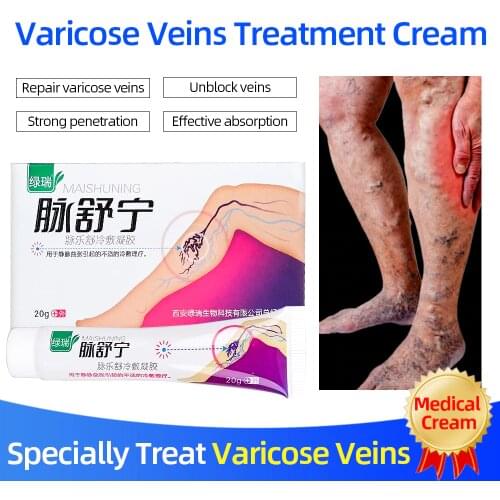 Varicose Veins Treatment Oinment Varicosity Angiitis Varicocele Remove Ointment Relief Pain Phlebitis legs Varicose Veins Care