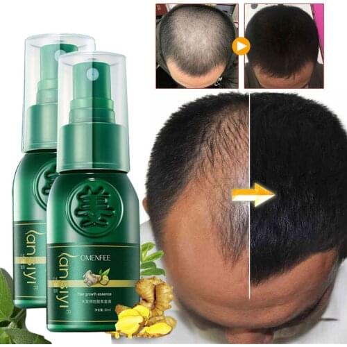 2 Pcs 7 Days Ginger Hair Growth Spray Serum Anti Hair Loss Products Fast Grow Prevent Hair Oil Dry Damaged Thinning Repair Care