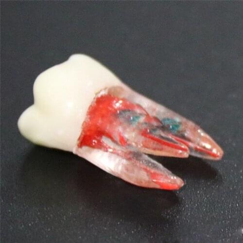 1pcs Dental Surgery Resin Endodontic Practice Operation Model With Colored Root Canal teeth model