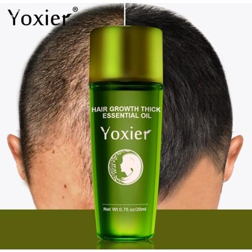 Yoxier Hair Growth Essential Oil Thick Fast Repair Growing Treatment Liquid Treatment Preventing Hair Loss Nourish Hair Roots