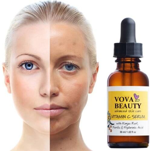 VOVA Vitamin C Whitening Face Serum Anti-Aging Brighten Skin Fades Spots Moisturizer Lift Shrink Pores Firm Nourishing Skin Care