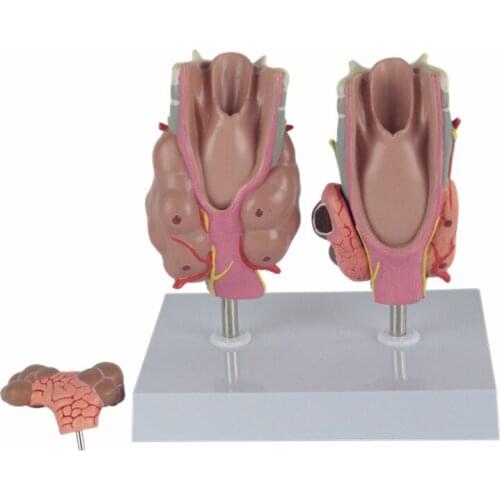 Thyroid pathology model throat anatomy thyroid disease model
