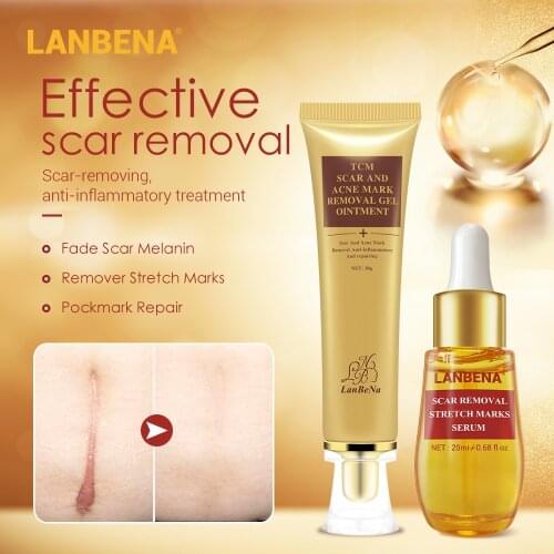 LANBENA Acne Scar Remove Cream Acne Treatment Serum Anti Acne Repair Stretch Marks Skin Shrink Pores Whitening Face Care 2pcs