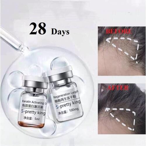 Stem Cell Hair Growth Serum Anti Hair Loss 28 Days Fast Grow Prevent Thinning 2pcs/Set Hair Care Essence