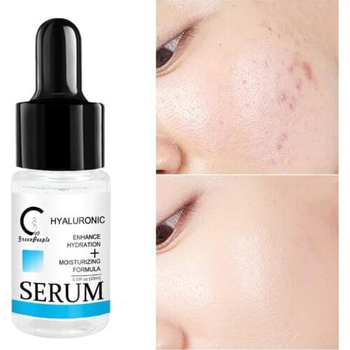 GreenPeople Hyaluronic Acid Serum Shrink Pore Face Serum Moisturizing Whitening Face Essential Oil Dry Skin Care New Brand