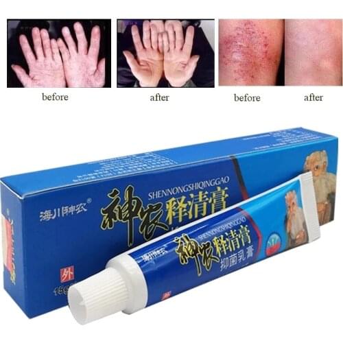 15g Traditional Herbal Skin Antibacterial Cream Herbal Antibacterial Ointment Psoriasis Dermatitis Eczema Antipruritic Cream