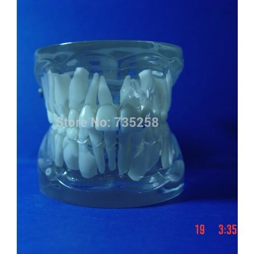 9 to 12 Years Old Childrens Tooth Development Model,Model of The Mixed Dentition