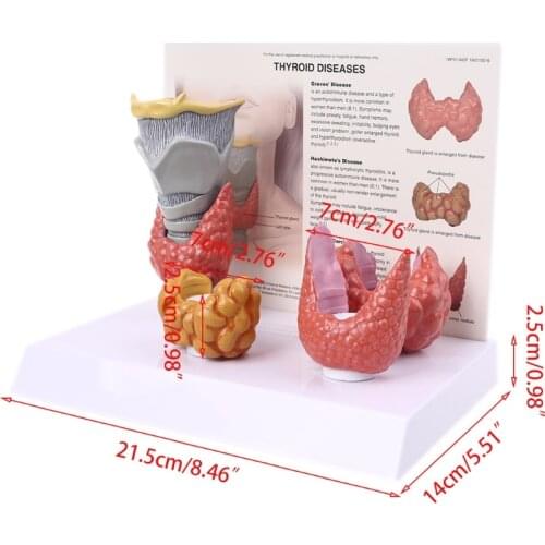 Human Anatomical Thyroid Gland Model Pathology Anatomy Digestive System Display 1XCB