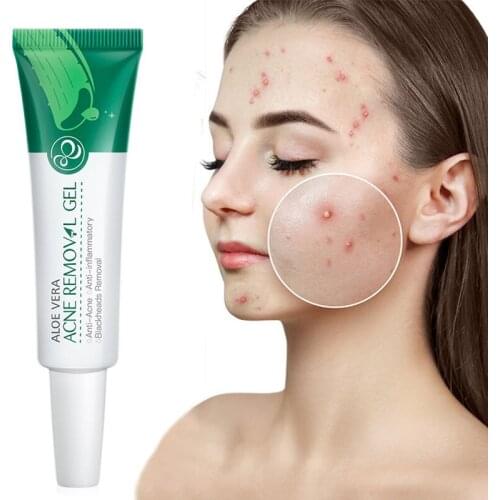 Aloe Acne Treatment Gel Face Cream Serum Anti Acne Scar Cream Shrink Pores Moisturizing Oil Control Soothing Essence Skin Care