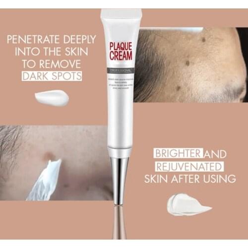 Effective Acne Removal Cream Acne Treatments Remove Melasma Spot Pigment Melanin Moisturizing Gel Freckle Cream Skin Care TSLM1