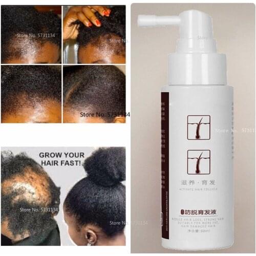HERBAL HAIR GROWTH Oil, Treats any hair condition, Treats alopecia