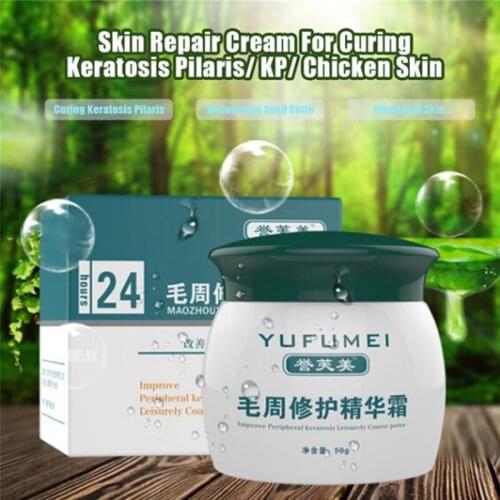 50g Moisturizing Body Cream Curing Keratosis Pilaris/ Kp/ Chicken Skin Body Lotion Skin Repair Cream Skin Care Essence Skin Care