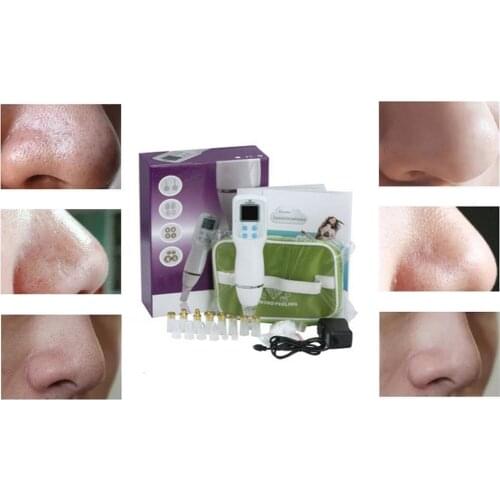 Blackhead Instrument Electric Cleansing Pore Cleaner Acne Facial Beauty To Blackhead Instrument Artifact