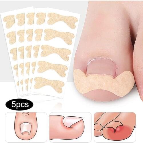 Bunion Corrector Ingrown Toenail Corrector Sticker Paronychia Treatment Fixer Recover bunion Pedicure Foot Toe Nail Care Tool