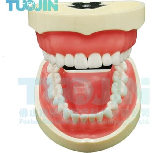 Orthodontics Dental Tooth Model Implants Resin Tooth 32 Model Removable Teeth Dentist Oral Student Model Dentist Teaching unit