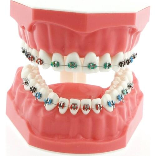 Dental Teach Typodont Demonstration Teeth Model with Metal Brackets Wires Ties Tubes For Patient Study 1:1 M7010-1