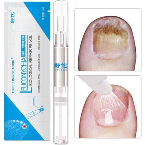 3ML Anti Fungal Treatment Nail Pen Onychomycosis Paronychia Infection Herbal Toe Finger Repair Nails Health Beauty Tool T1212