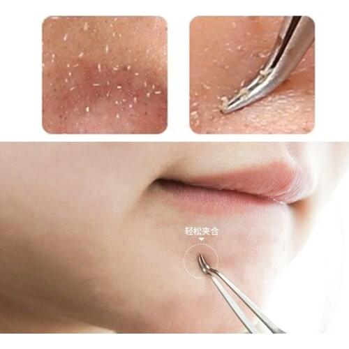 Useful Stainless steel Straight Bend Curved Blackhead Acne Clip Tweezer Pimple Comedone Remover Kit Face Cleaner