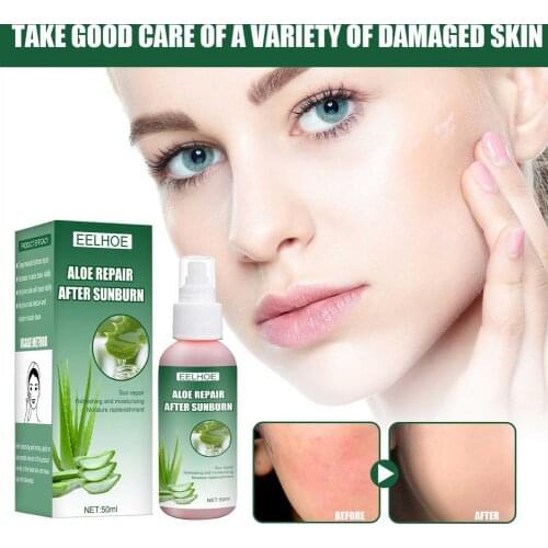 Aloe Vera Essence Spray Repair Sunburn Sensitive Skin Improve Rough Skin Aloe Vera Essence Moisturizing Sooth Skin Face Care