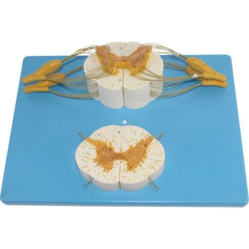 Spine and spinal nerve branch enlargement model spinal cord transverse