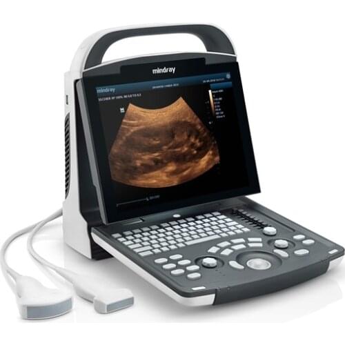 Original Factory Supply Mindray Dp-10 Portable Medical Ultrasound Scanner Available price ultrasound scanner