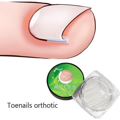 3 Bottles of 10pcs/set Ingrown Nail Pad Ortho Nail Filling Nail Groove Pad Ingrown Nail Corrector Ingrown Nail Artifact