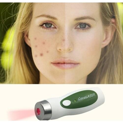 5mW low level laser therapy Anti Aging Scars Acne Laser Removal Facial Beauty Skin Care no pain no side effect