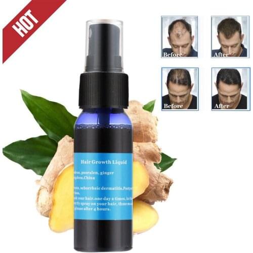 Fast Growth Hair Liquid Serum Pilatory Liquid Serum TSLM1