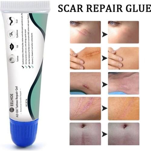 1 Pcs Repair Scar Removal Cream Acne Scars Gel Stretch Marks Surgical Scar Burn Care