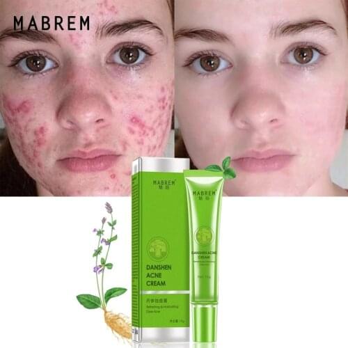 Herbal pure natural mild salvia miltiorrhiza plant acne cream clean condenses pores moisturize smooth skin care cream