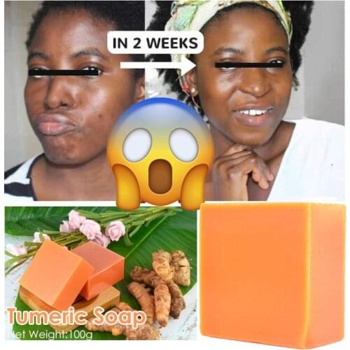 Tumeric Soap Whitening Soap Natural To Lightening Acne Dark Spots Skin Glow Brighter Scars Removal Soap Bars 100g