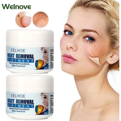 30/50g Warts Removal Cream Skin Tag Remover Wart Treatment Remove Mole Foot Corn Wart Antibacterial Ointment Herbal Plaster
