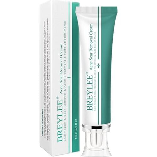 Removal Scar Cream Face Pimples Scar Stretch Marks Removal Acne Treatment Whitening Moisturizing Cream Skin Care