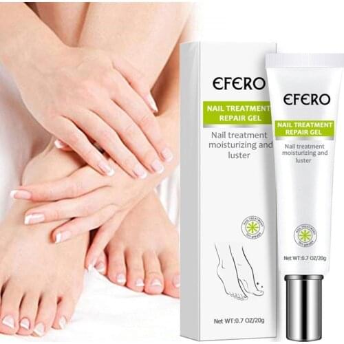 Herbal Fungal Nail Treatment Essence Nail Foot Toe Nail Fungus Removal Gel Anti Infection Paronychia Onychomycosis Foot Repair