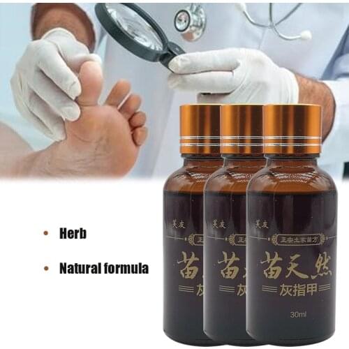 30ML Herbs Fungal Nail Treatment Essence Serum Repair Toe Nail Fungus Removal Gel Anti Infection Paronychia Onychomycosis