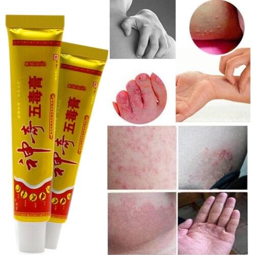 15g Herbal Psoriasis Treatment Cream Psoriasis Ointment Dermatitis Eczematoid Eczema Ointment Skin Treatment Anti-itching Cream