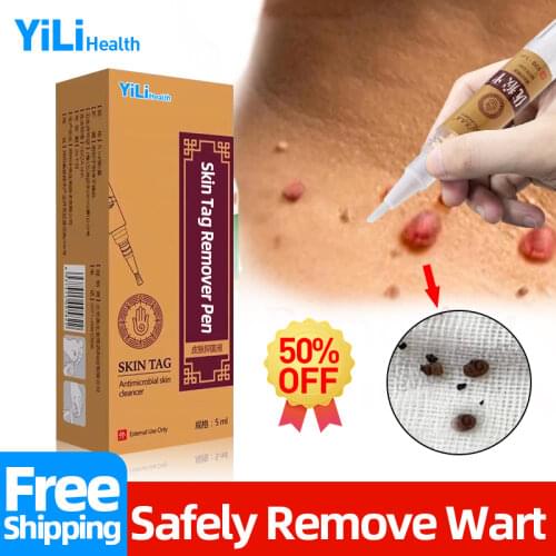 Skin Tag Remover Liquid Against Mole Wart Removal Pen Genital Warts Remove Tool Chinese Herbal Treatment Papillomas Corn Feet