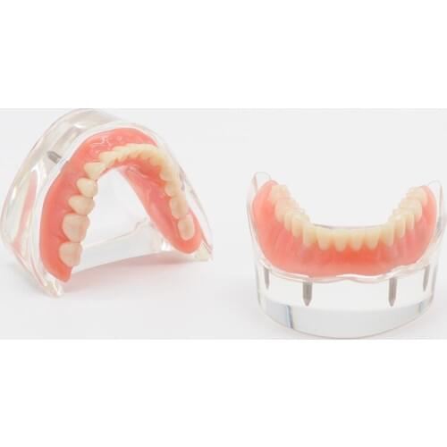 Dental Lab Lower Mandibular 2/4 Implants Dental Restoration Teeth Teaching Model Dentistry
