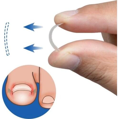 10Pcs Ingrown Toenail Pedicure Tool Straightening Clip Toenails Correction Elastic Patches Toenail Treatment Foot Nail Care