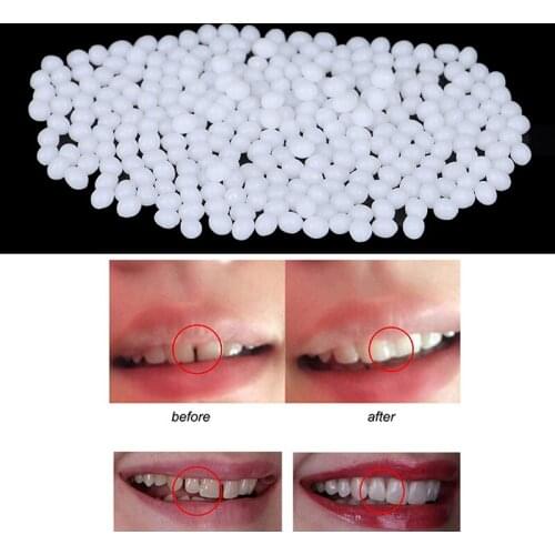5/10/15/20g Temporary Tooth Repair Kit Teeth And Gaps FalseTeeth Solid Glue Denture Adhesive Teeth Whitening Tooth Beauty Tool