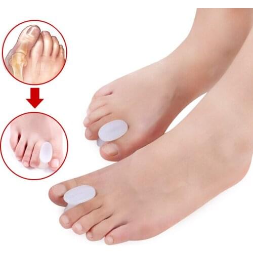 1/2Pair Hallux Valgus Corrector Silicone Thumb Bunion Correction Foot Care Orthopedic Tools Finger Toes Separator Straightener
