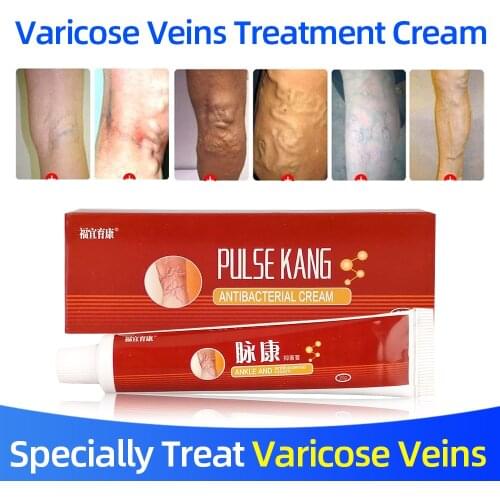 2PC Varicose Veins Treatment Ointment To Relieve Vein Pain Phlebitis Legs Angiitis Herbal Health Care Cream