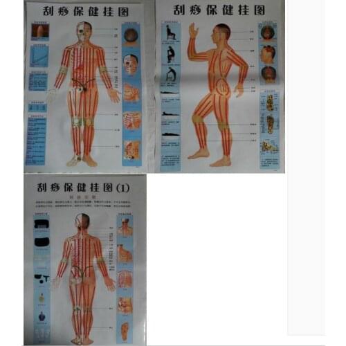 3 pcs acupuncture cupping/scraping massage charts front/back/side acupuncture treatment massage map