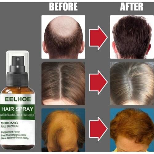 30ML/50ML Fast Hair Growth Spray Growing Hair Oil Nourish Hair Roots Prevent Hair Loss Hair Loss Care Spray For Men Women TSLM1