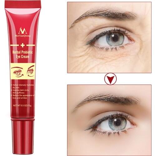 Shea Butter Instant Remove Eye Bags Cream Anti Puffiness Dark Circles Delays Aging Fades Wrinkles Firming Brighten Skin Unisex