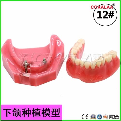 Good quality Mandibular model dental patient communication implant model dentures teeth model for dentists learning