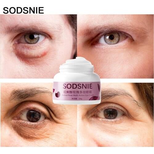 Eye Cream Moisturizing Nourish Remove Wrinkles Anti-Aging Brighten Protect Lift Tighten Hydrate Retinol Rose Skin Care 30g